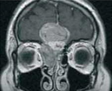 ある部位①をMRIで測定した画像例