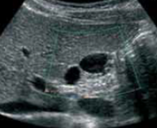 Example photo of part of body 3 by Ultra Sonography